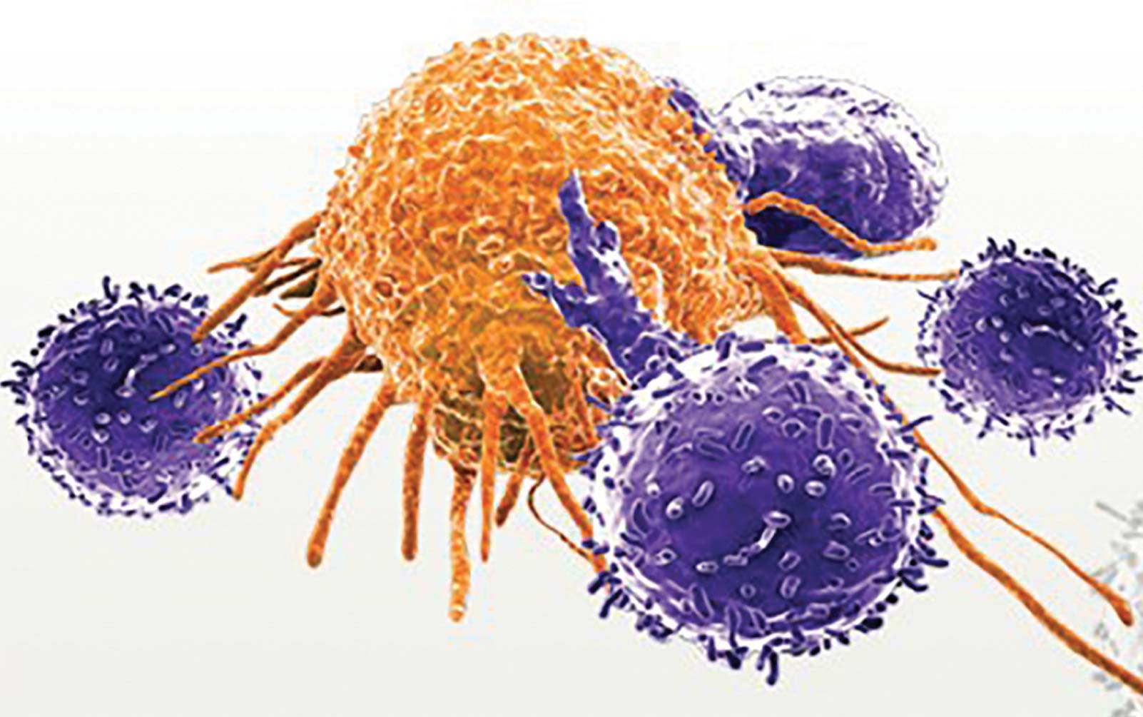 CAR-T Cells for Lung Cancer: Q&A with Dr. Charu Aggarwal