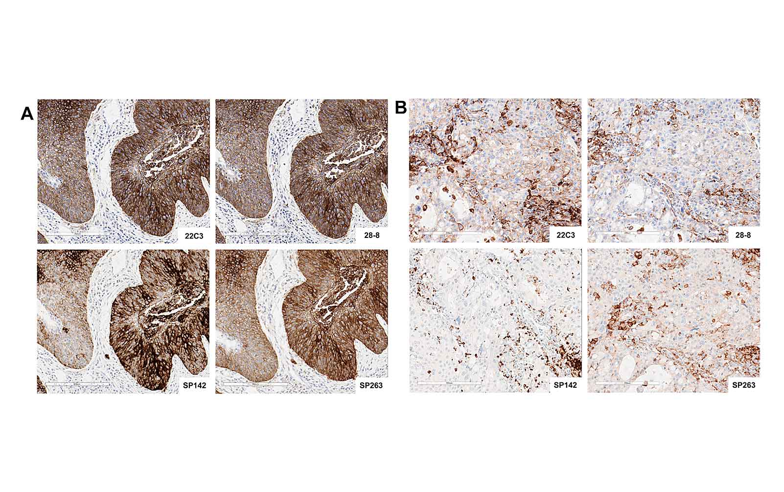 PD-L1 IHC Blueprint Project” Presented at the AACR Annual Meeting 2016