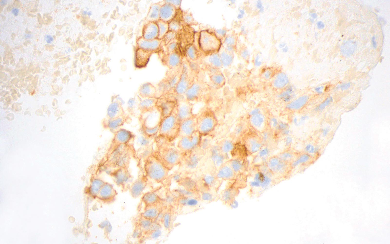 PD-L1 in Cytology Specimens