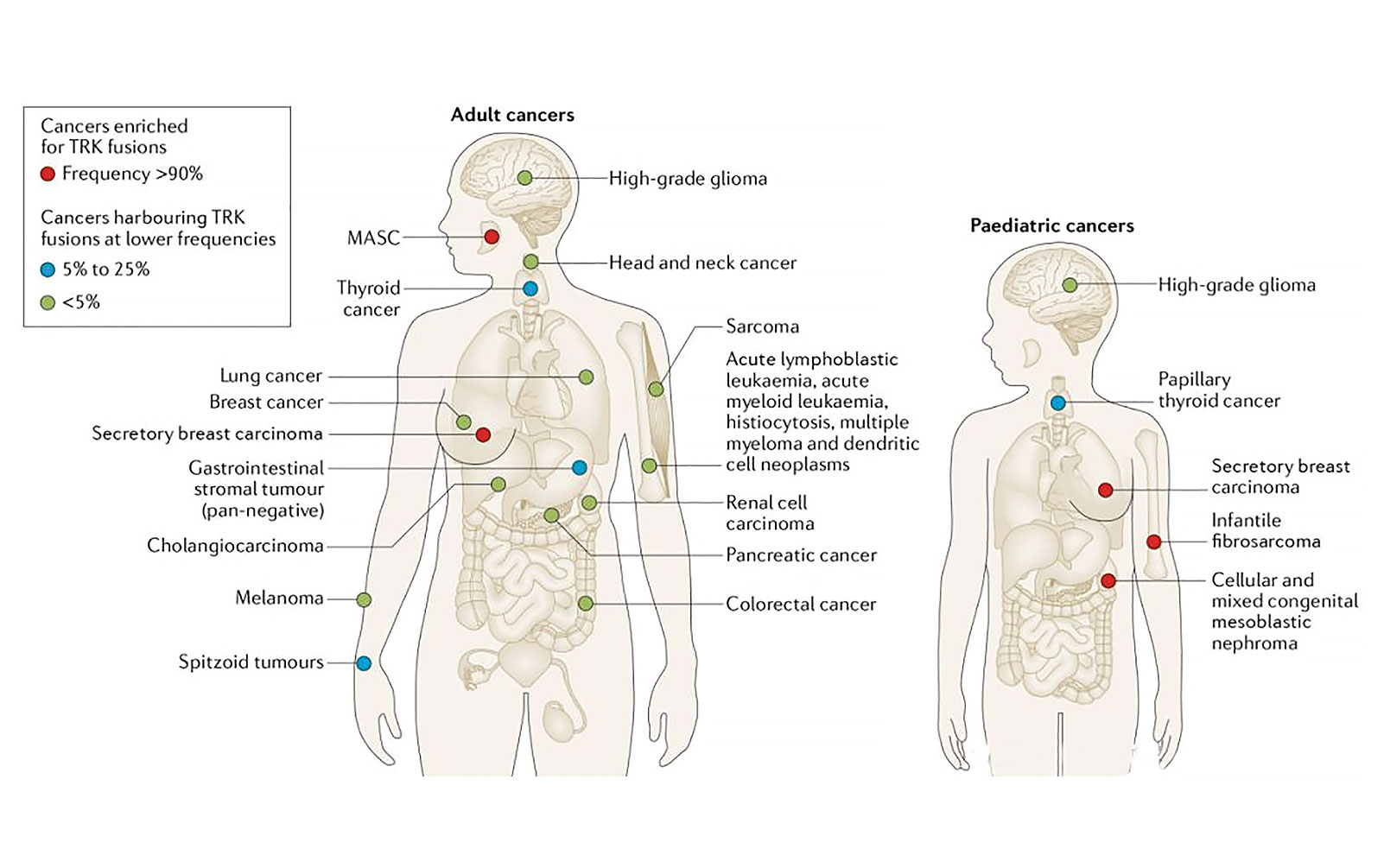 TRK Inhibition in TRK Fusion–Positive Lung Cancers