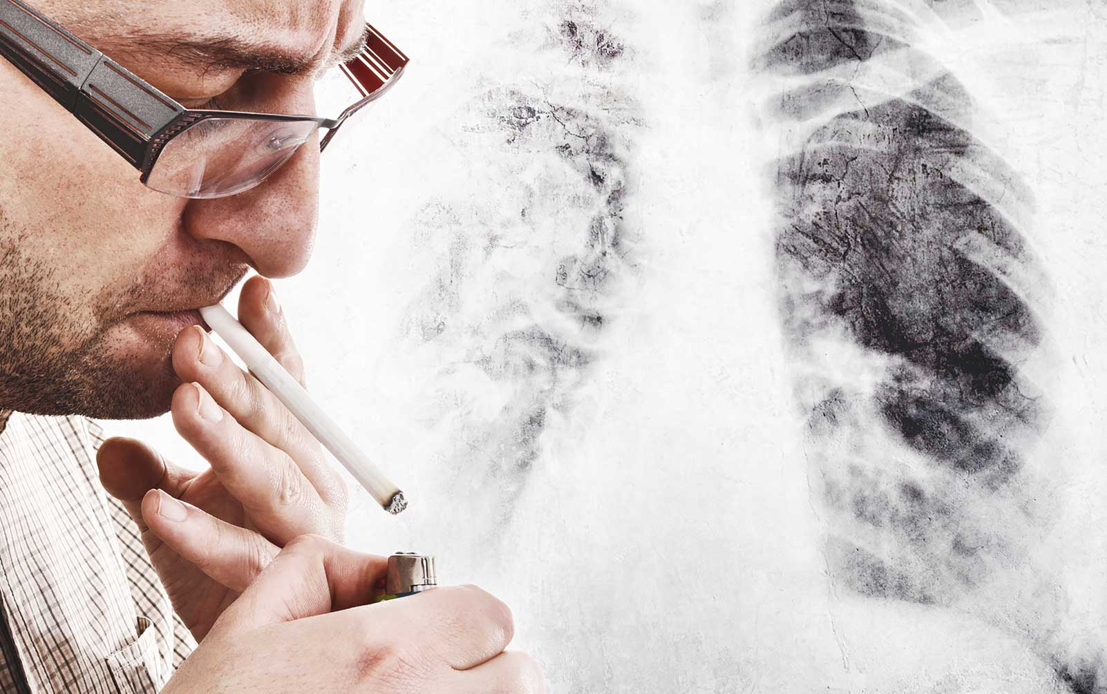 Genetic Differences in Lung Cancers Arising in Smokers and Never-Smokers