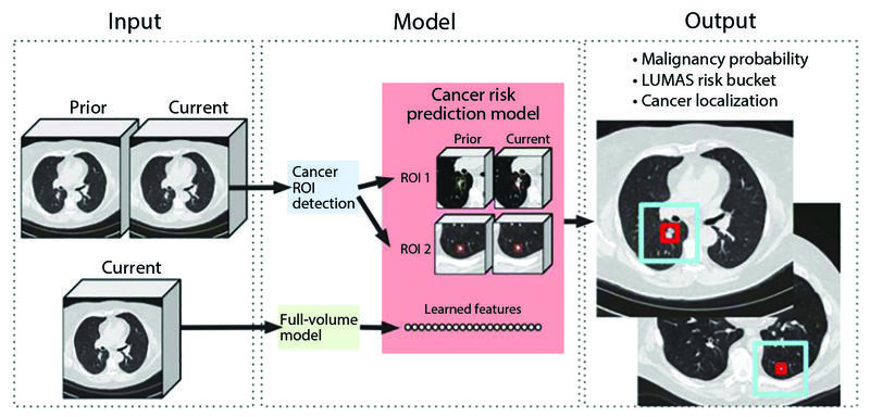 AI in lung_Fig 1