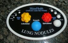 3D Model of Lung Nodules Reduces Anxiety for Patients While Helping Them Understand Their Cancer Risk
