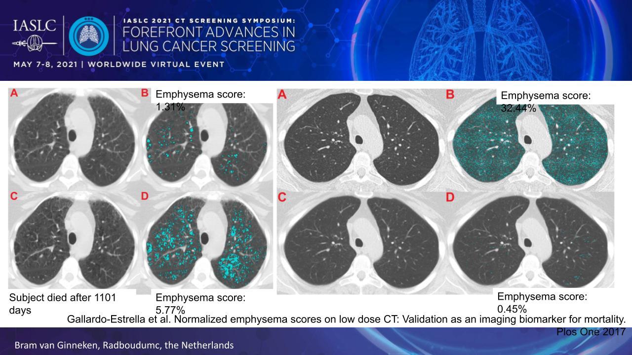 CTSS.quantitative measures.van Ginneken.fig 1.pptx_.jpg