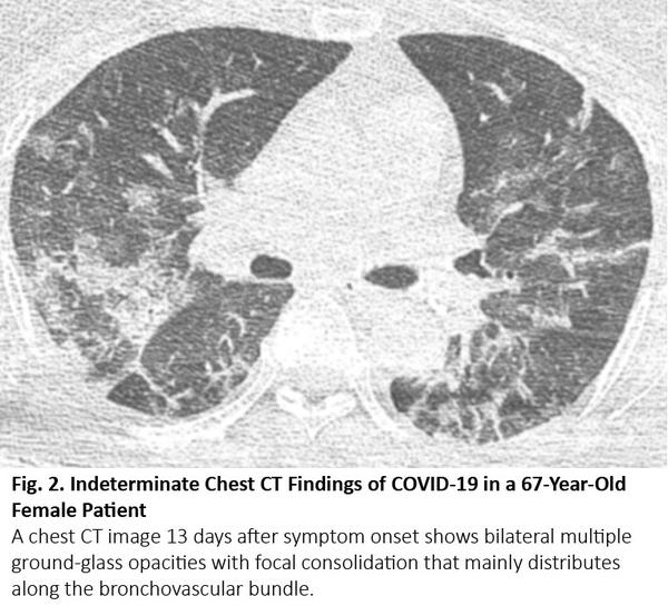 Figure-2-CT-COVID_Yoon