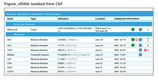 Figure. cfDNA Isolated from CSF