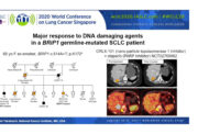 Hereditary Predisposition Plays a Larger Role in SCLC Development Than Previously Recognized and May
            Inform Personalized Treatment