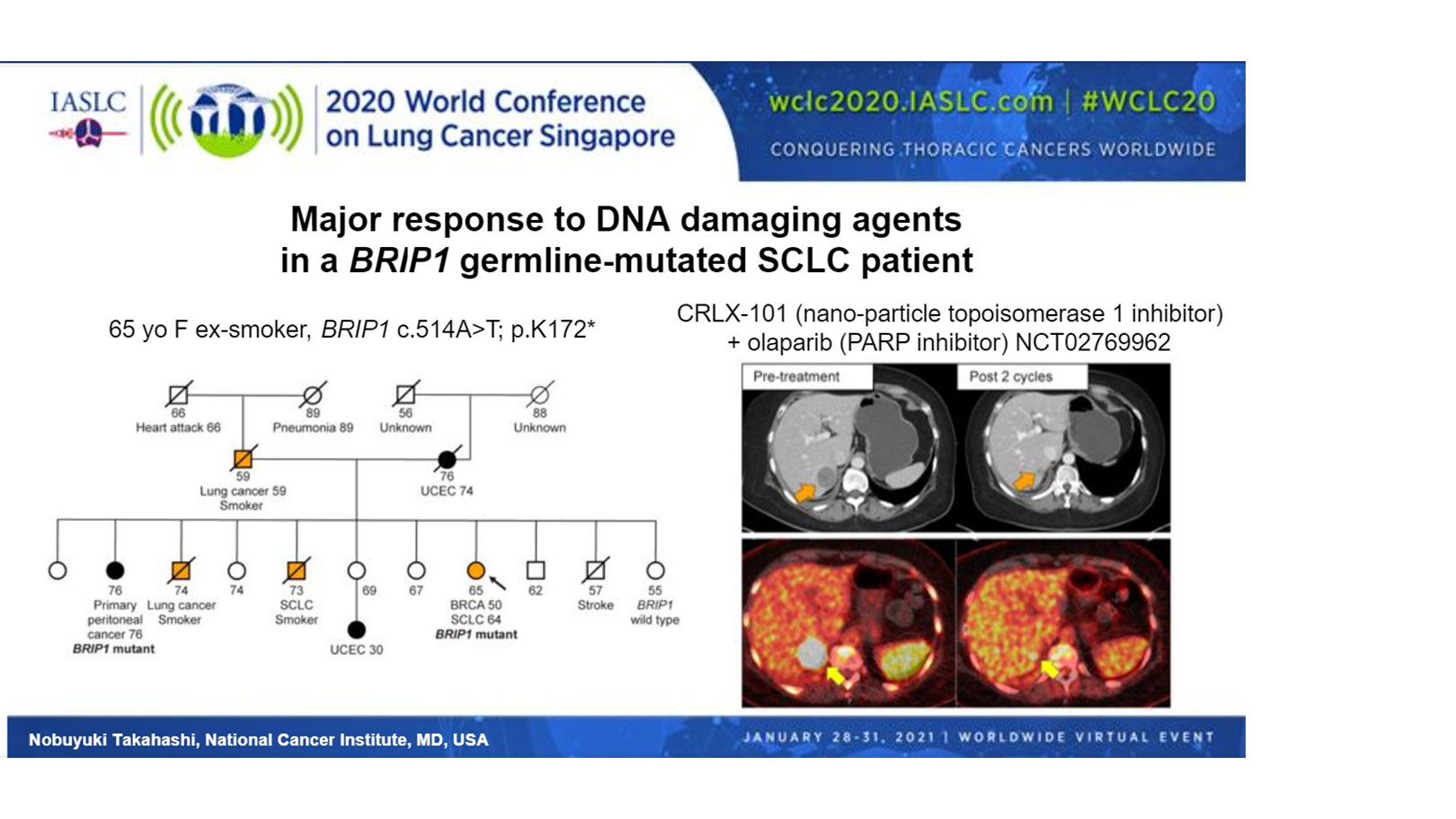 Hereditary Predisposition Plays a Larger Role in SCLC Development Than Previously Recognized and May
            Inform Personalized Treatment